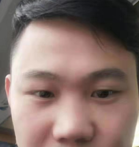 眼袋