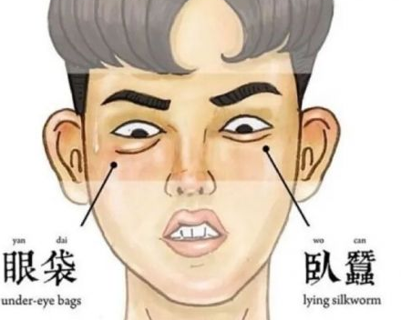 眼袋