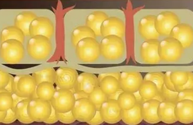 自体脂肪丰胸