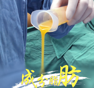自体脂肪丰胸