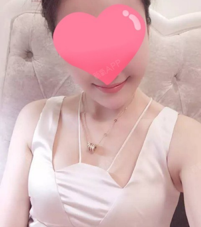 自体脂肪丰胸
