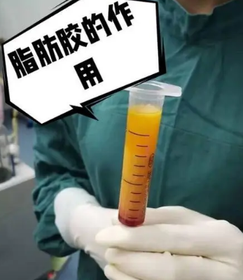 自体脂肪丰胸