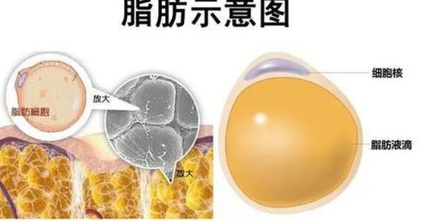 自体脂肪填充