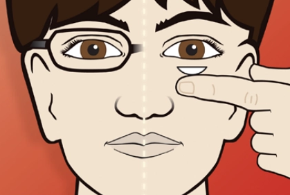眼袋