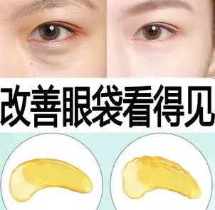 眼袋手术