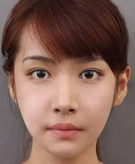 眼袋手术