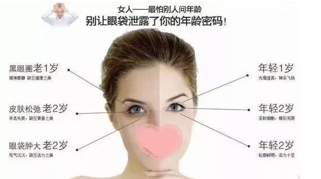 眼袋手术