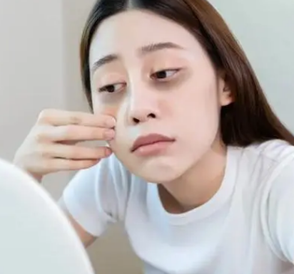 去眼袋手术
