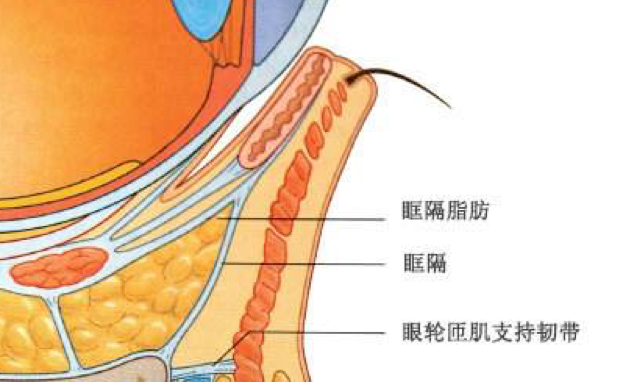 去眼袋手术