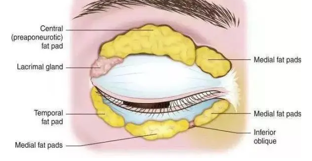去眼袋手术