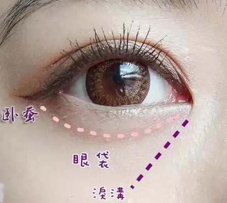 眼袋