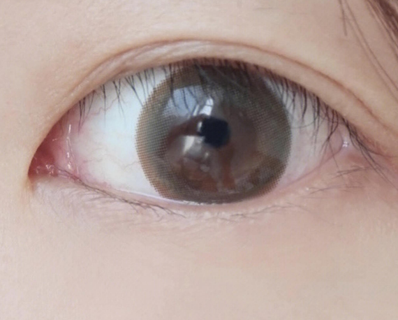眼袋