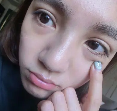 眼袋
