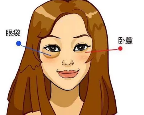 去眼袋手术