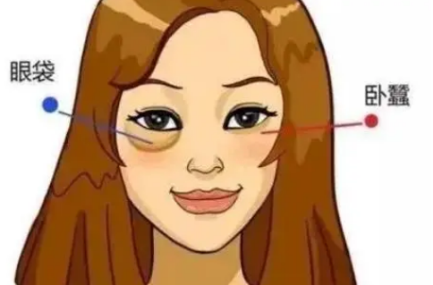 去眼袋手术