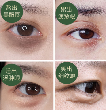 眼袋