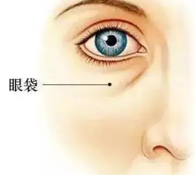 眼袋