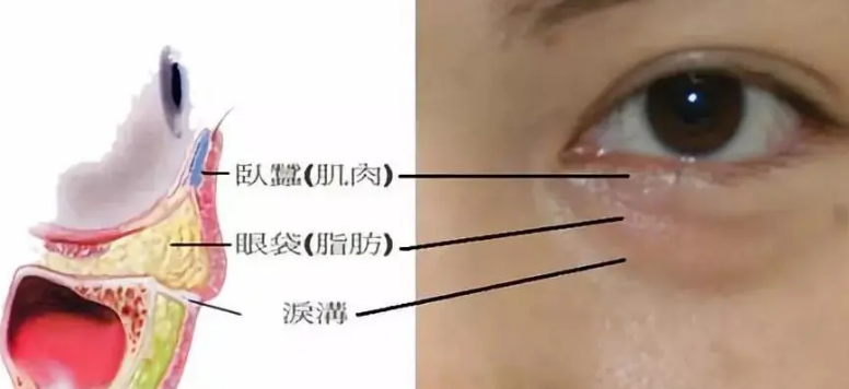 去眼袋手术