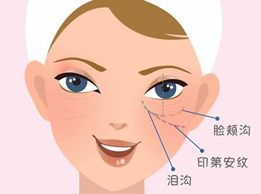 眼袋