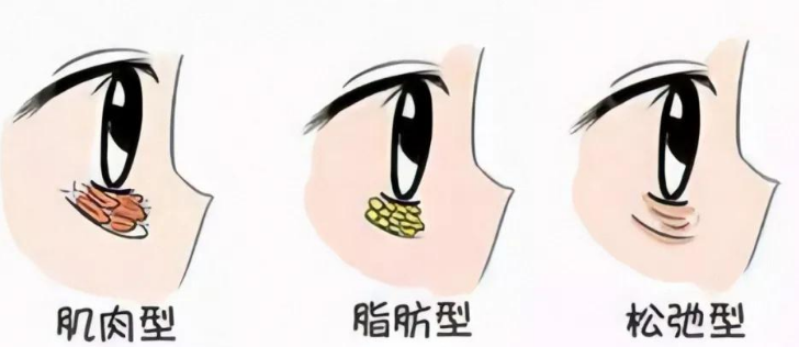 眼袋