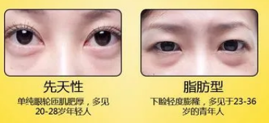 眼袋