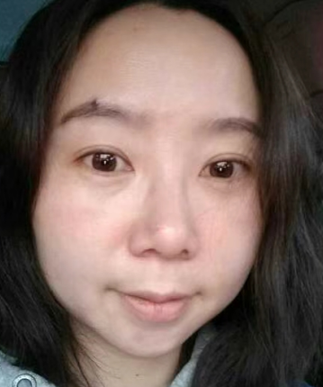 眼袋
