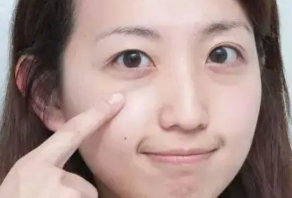 眼袋