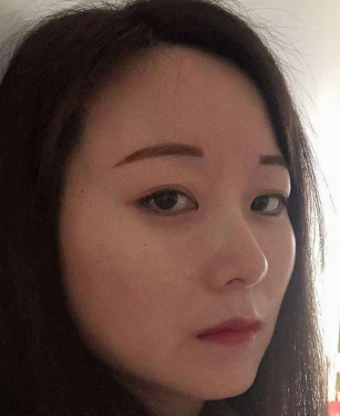 去眼袋手术