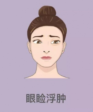 眼袋
