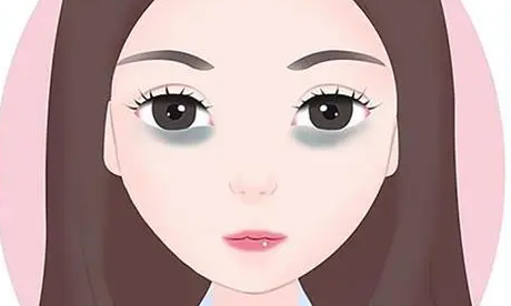 眼袋手术