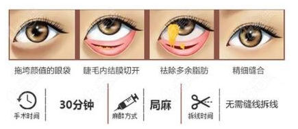 眼袋