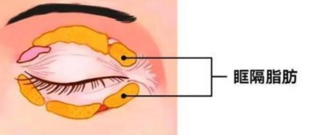 眼袋