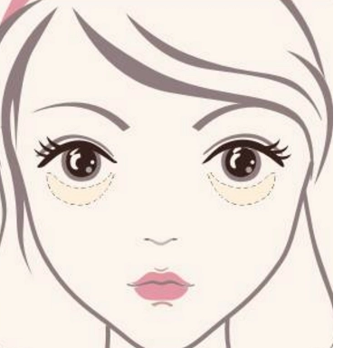 眼袋