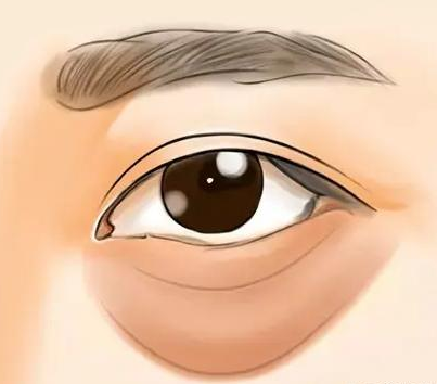 眼袋