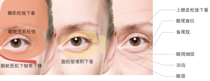 眼袋