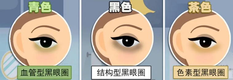 眼袋