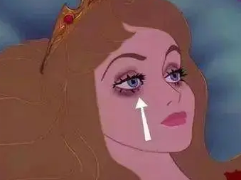 眼袋