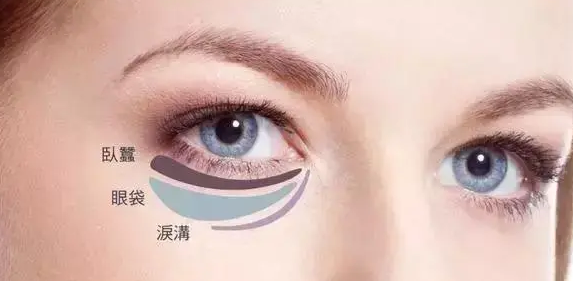 眼袋