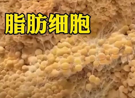自体脂肪胶填充