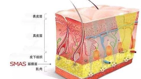 自体脂肪胶填充