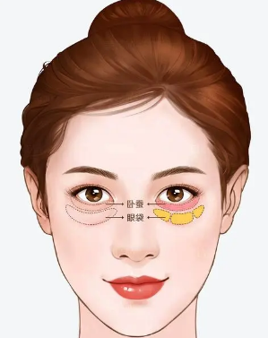眼袋