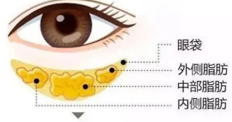 眼袋