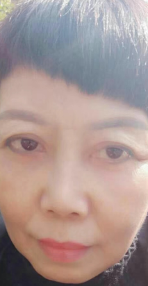 去眼袋手术