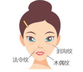 去眼袋手术