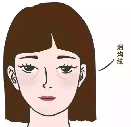 去眼袋手术