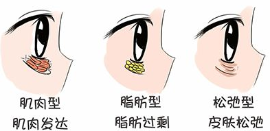 眼袋