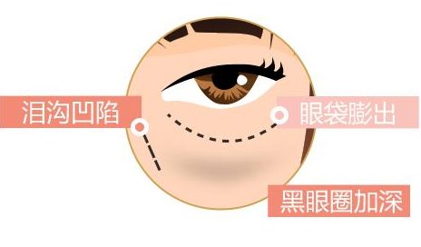 眼袋
