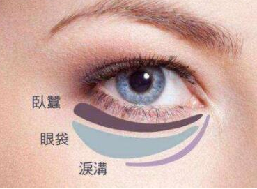 眼袋