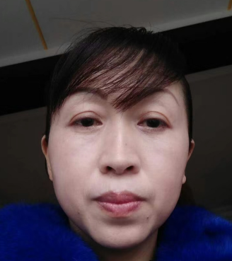 眼袋