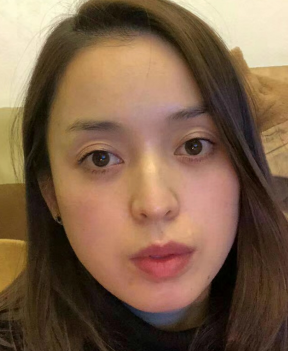 眼袋